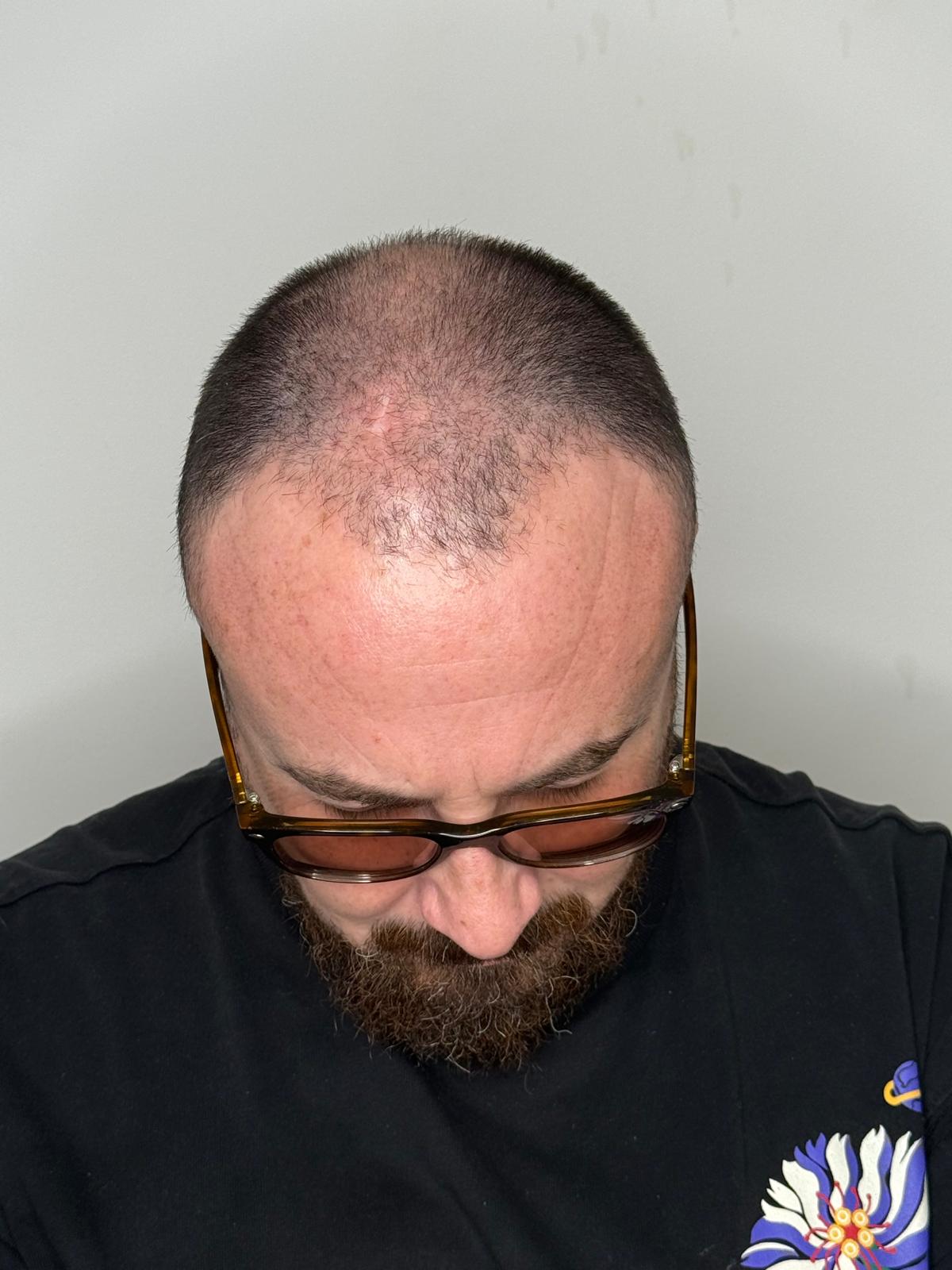 Prima del trattamento