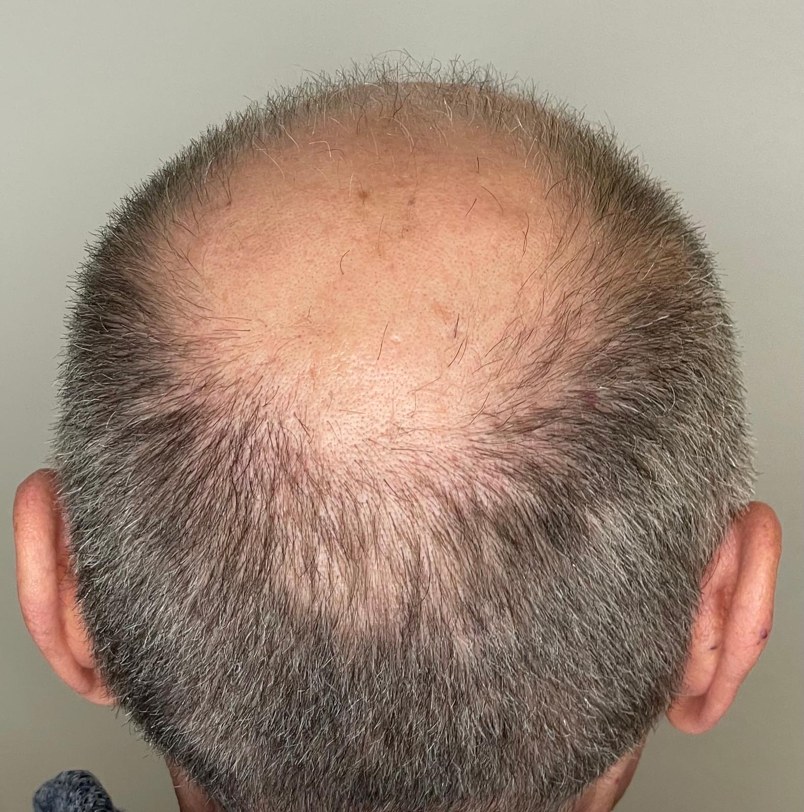 Prima del trattamento